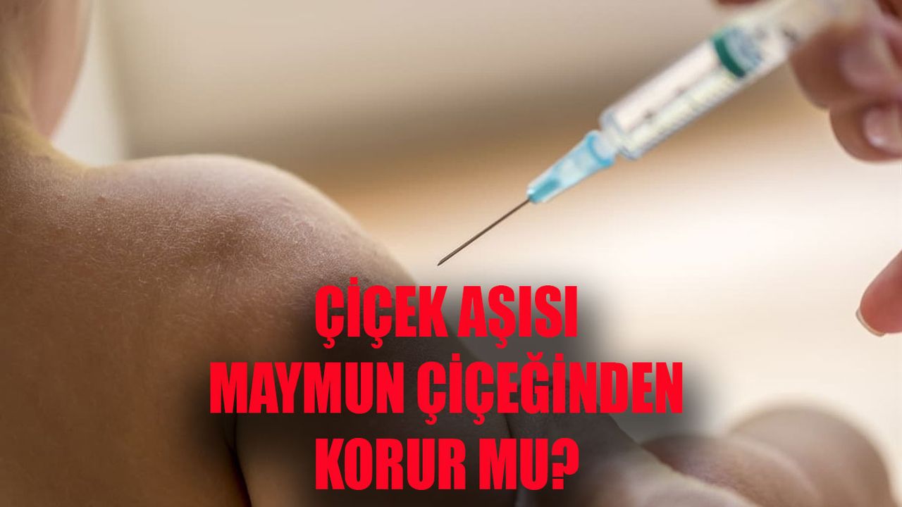 Çiçek aşısı ne zaman kaldırıldı? Su çiçeği aşısı maymun çiçeğinden korur mu?