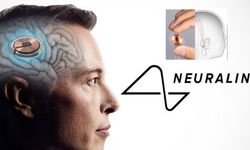 Elon Musk, Neuralink'in beyin çipinin ilk kez bir insana yerleştirildiğini duyurdu