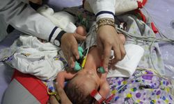 Gazze'de bebekler 'açlık'tan ölüyor...