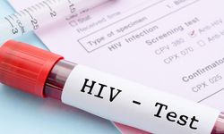 HIV nedir? İşte belirtileri ve bulaşma yolları!