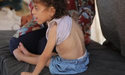 Filistinli çocuklarda yetersiz beslenme vakaları hızla artıyor