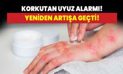 Korkutan uyuz alarmı! Yeniden artışa geçti!