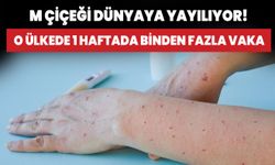 M çiçeği dünyaya yayılıyor! O ülkede 1 haftada binden fazla vaka