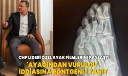 CHP Lideri Özgür Özel ayak filmlerini paylaştı! 'Ayağından vuruldu' iddiasına röntgenli yanıt