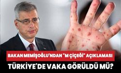 Sağlık Bakanı Memişoğlu'ndan "M çiçeği" açıklaması