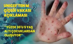 UNICEF'ten M çiçeği vakası açıklaması: Yüzde 30'u 5 yaş altı çocuklardan oluşuyor