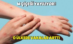 M Çiçeği yayılıyor! O ülkede vakalar arttı