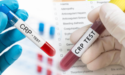 CRP türbidimetrik nedir? CRP yüksekliği ne anlama gelir?