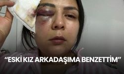 Yolda yürüyen kıza yumruk atan adamın ifadesi; "Eski kız arkadaşıma benzettim."