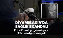 Diyarbakır'da sağlık skandalı! En az 75 hastaya gereksiz yere platin takıldığı ortaya çıktı