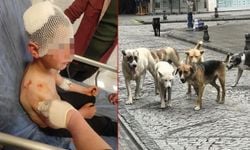 Isparta’da sokakta oynayan çocuğa başıboş köpek saldırdı