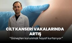 Cilt kanseri vakalarında artış: Güneşten korunmak hayat kurtarıyor