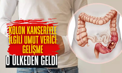 Kolon Kanserine Karşı Yeni Genetik Yöntem Geliştirildi