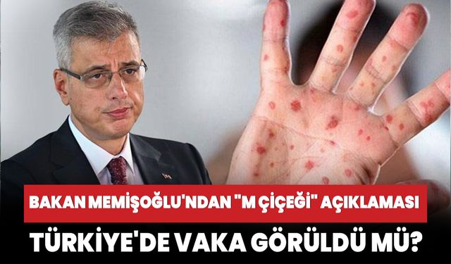 Sağlık Bakanı Memişoğlu'ndan "M çiçeği" açıklaması