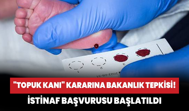 Mahkemenin "topuk kanı" kararına Sağlık Bakanlığından jet itiraz