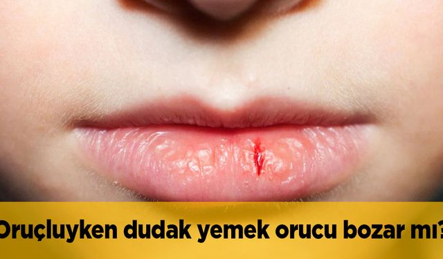Oruçluyken dudak yemek orucu bozar mı?