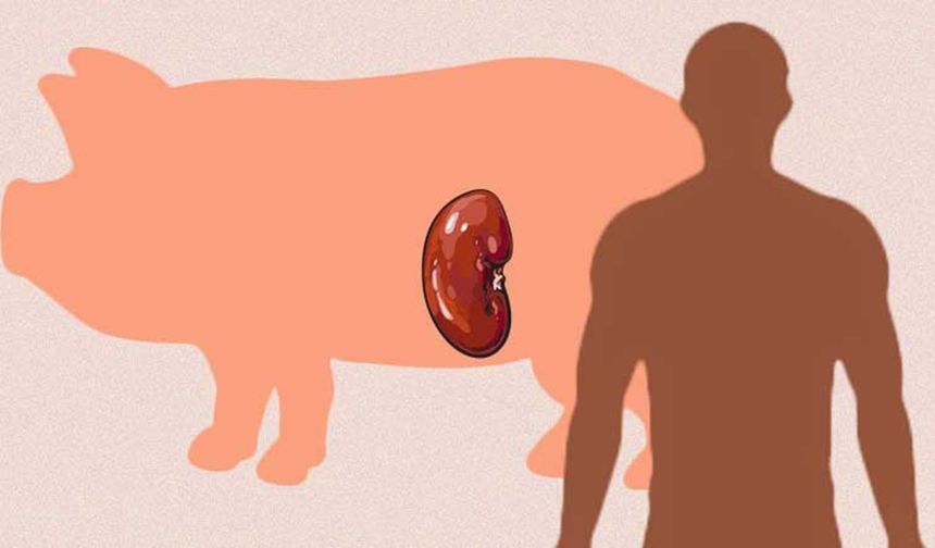 ABD'de ilk kez genetiği değiştirilmiş domuz böbreği nakli
