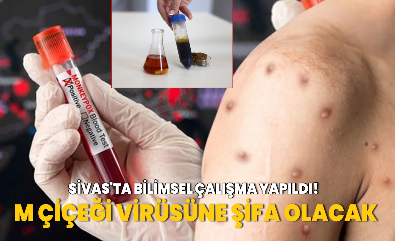 Sivas'ta bilimsel çalışma yapıldı! M çiçeği virüsüne şifa olacak